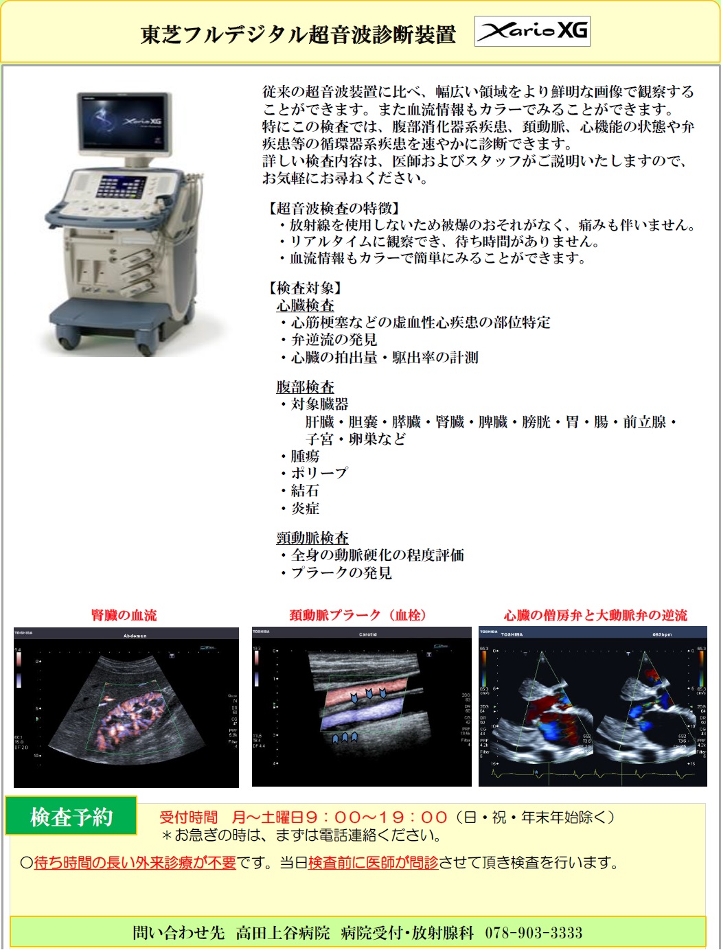 超音波診断装置