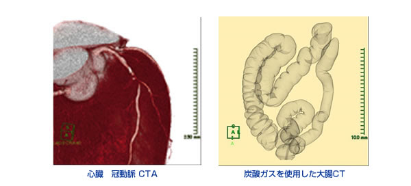 CT検査