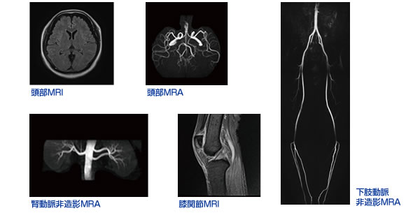 MRI検査